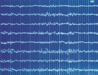 DSO EEG1.jpg